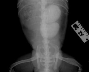 Radiograph reveals two large bladder stones in an iguana